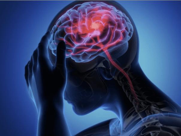  PTSD and VibroAcoustic Sound Therapy